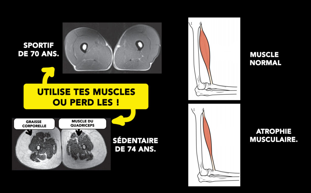 Exemple de composition corporelle: sédentaire VS sportif